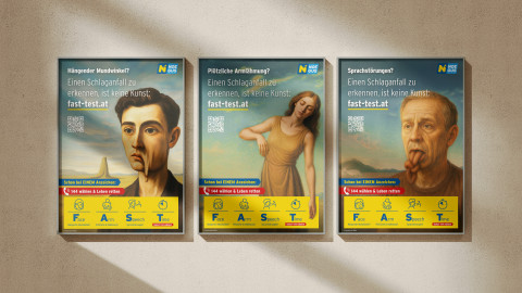 Einen Schlaganfall zu erkennen, ist keine Kunst.