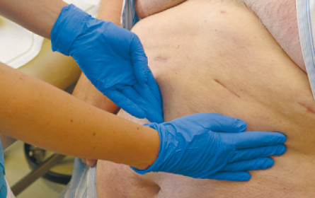 Zuckerkrankheit als Zeitbombe