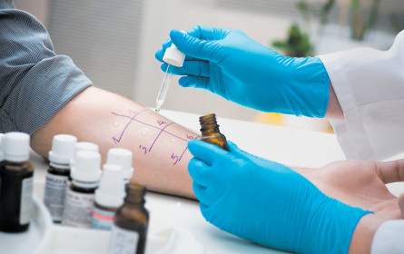 Birken, Gräser und Esche belasten die Volkswirtschaft