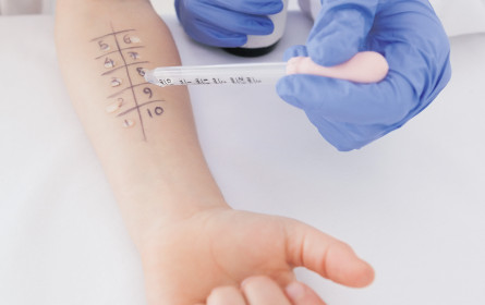 Allergie-Forschung aus Österreich führend