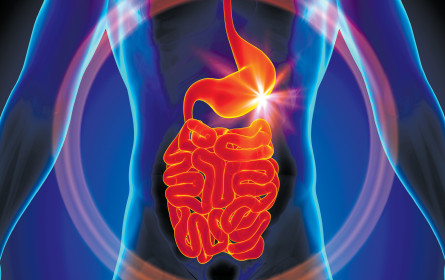 Forschung bringt Erfolge gegen Darmkrankheiten