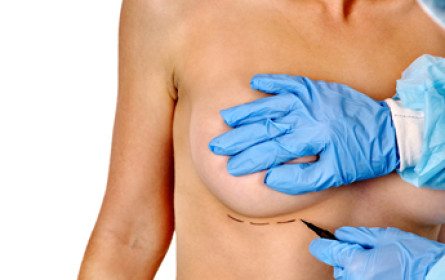 Brust-OP-Aktion von KroneHit: Fast 300 Anmeldungen bei Radiosender