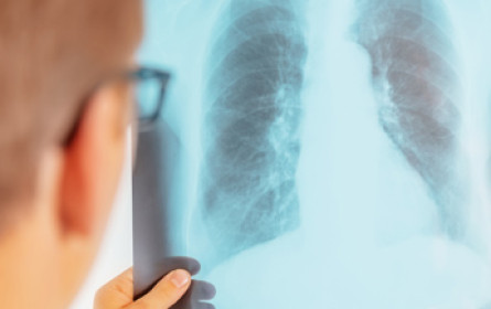 Ausschreibung: ÖGP-Journalistenpreis 2017