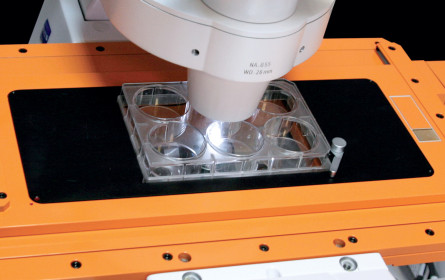 CSI-Krebs: So findet man die passende Therapie