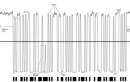 Strichcode: nicht schön, aber sehr notwendig