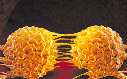 Simulation für Krebstherapie