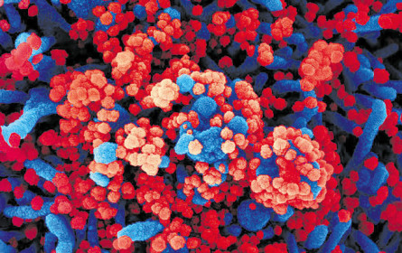 Virologen warnen vor neuen Erregern