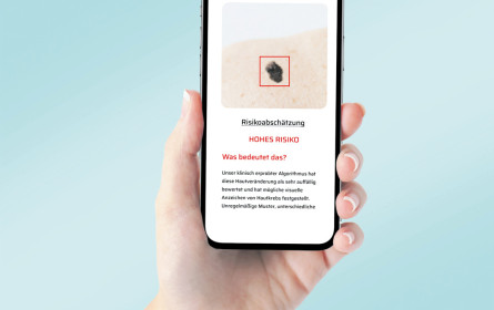Krebs: App ermöglicht Früherkennung