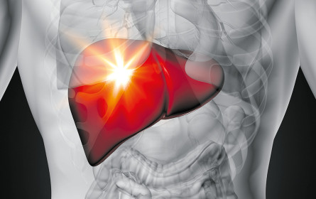 Test für Fettleber entwickelt